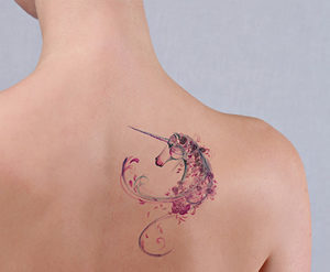 Laser Tattoo Removal, Before